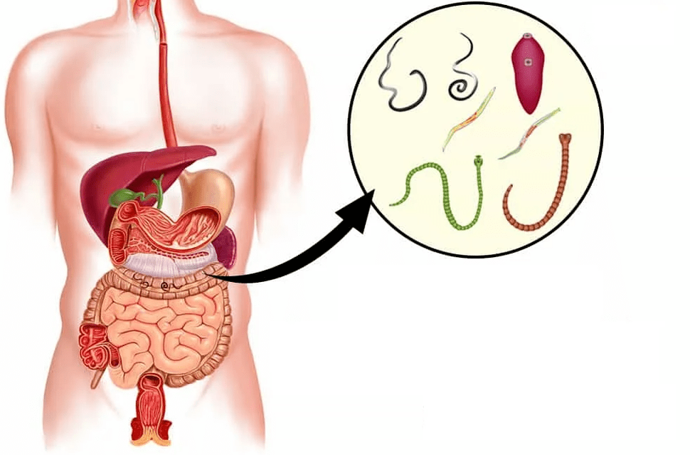 Helminths and worms in the gastrointestinal tract