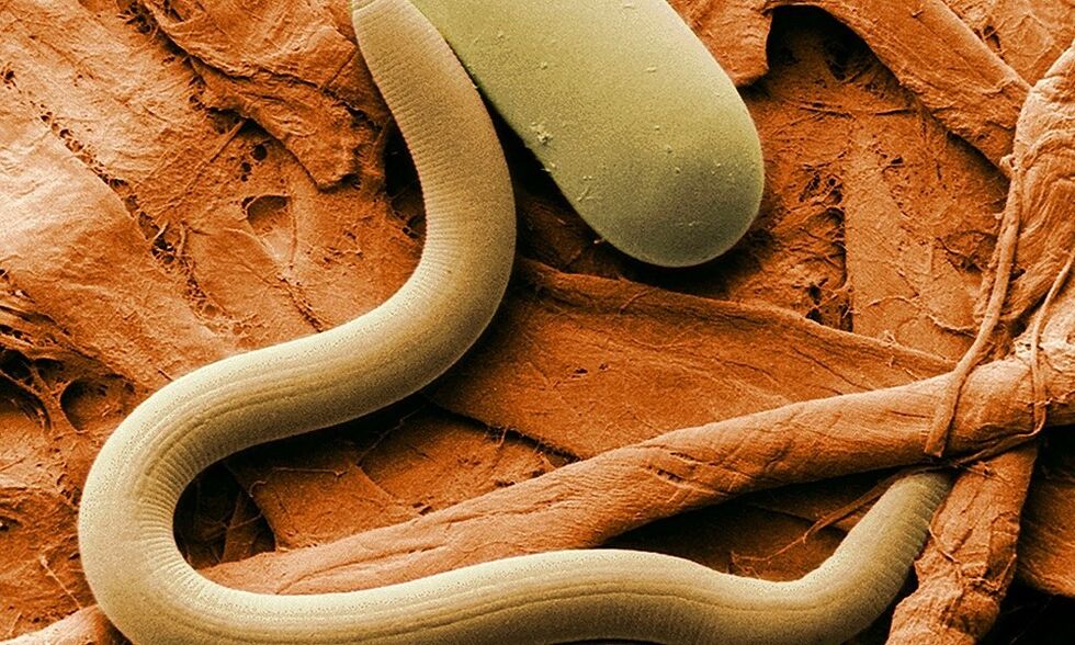 parasitic worm from the human body
