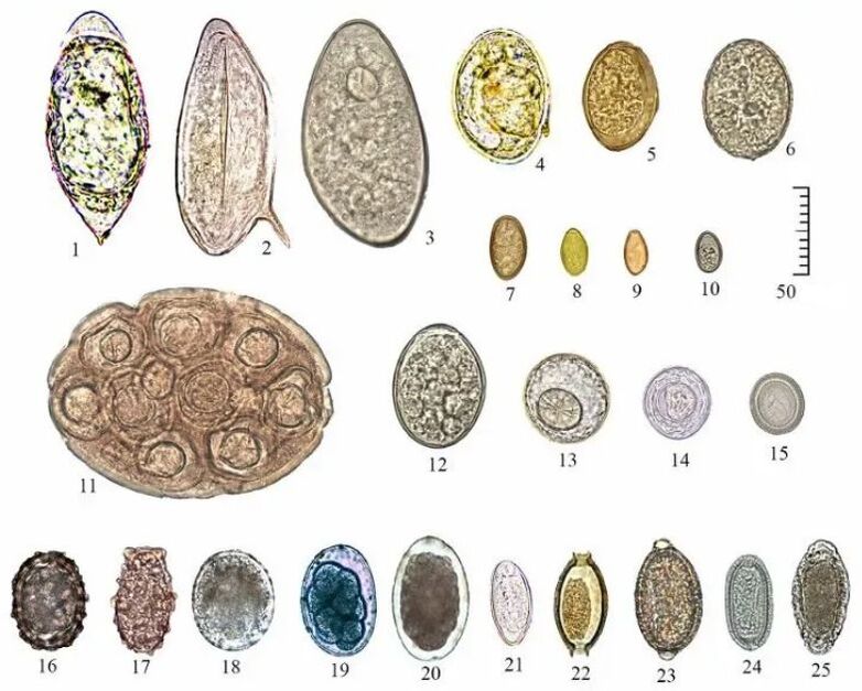 shape and size of eggs of different helminths