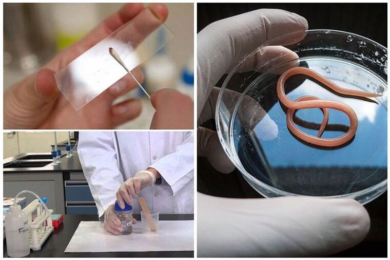 test for the presence of worms in the body