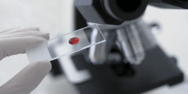 Blood tests